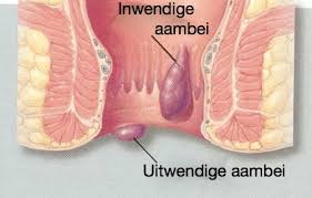 aambeien Aambeien. Niemand heeft ze! Jij toch ook niet!!!! - Natuurlijk gezond - Santura